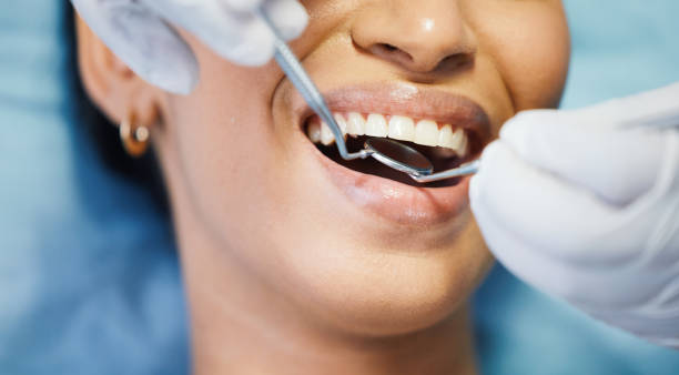 Best Emergency Root Canal Therapy in Fayetteville, AL